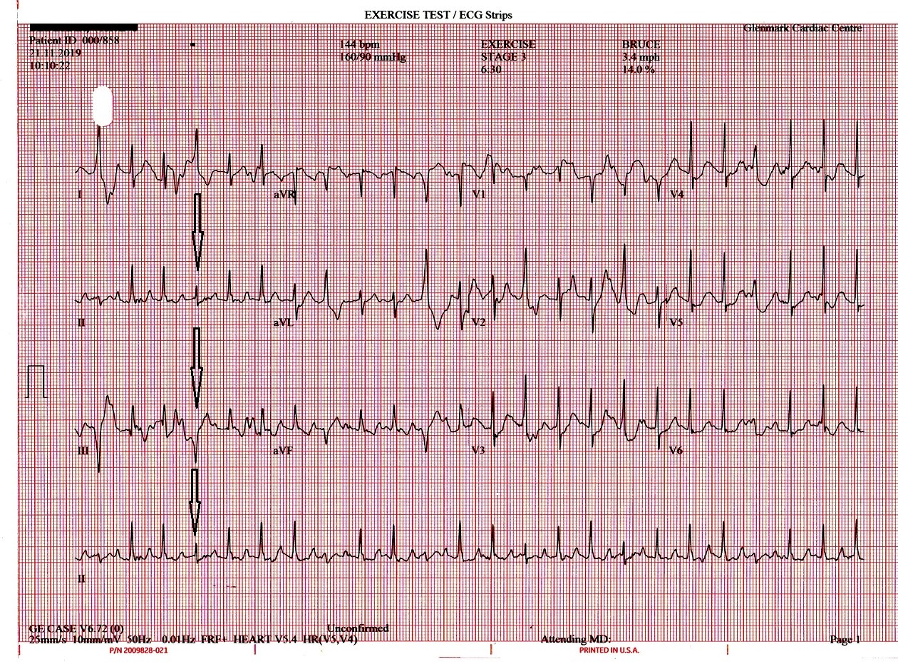 DECEMBER 2019 – Glenmark Cardiac Centre